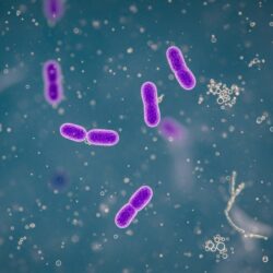 民泊運営について：プールやお風呂のレジオネラ菌対策と注意喚起